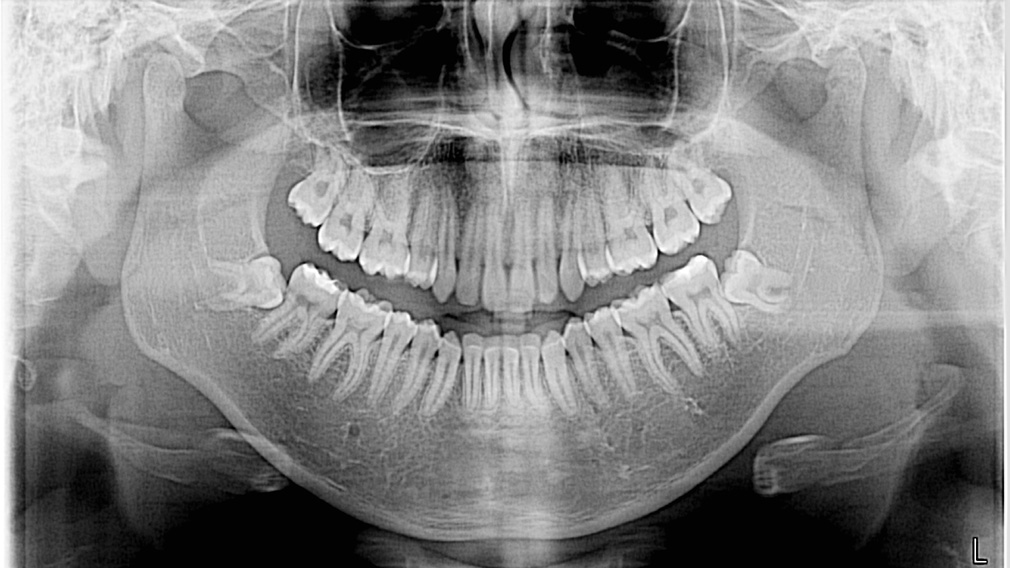 Ακτινοδιαγνωστική οδοντιατρική